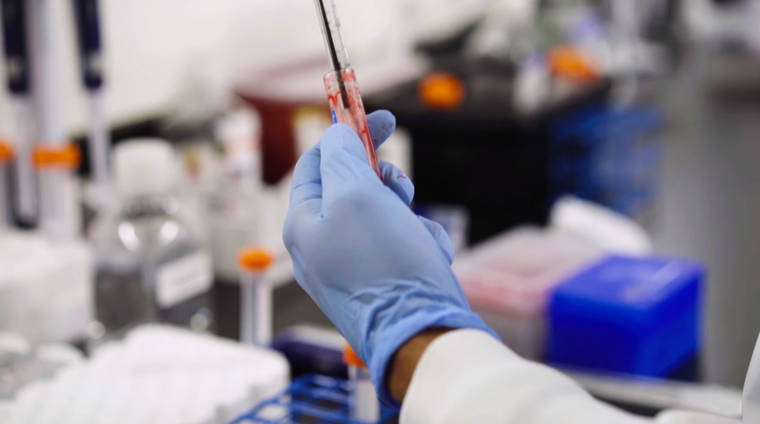 Advancing Cancer Diagnosis with AI at LungLifeAI